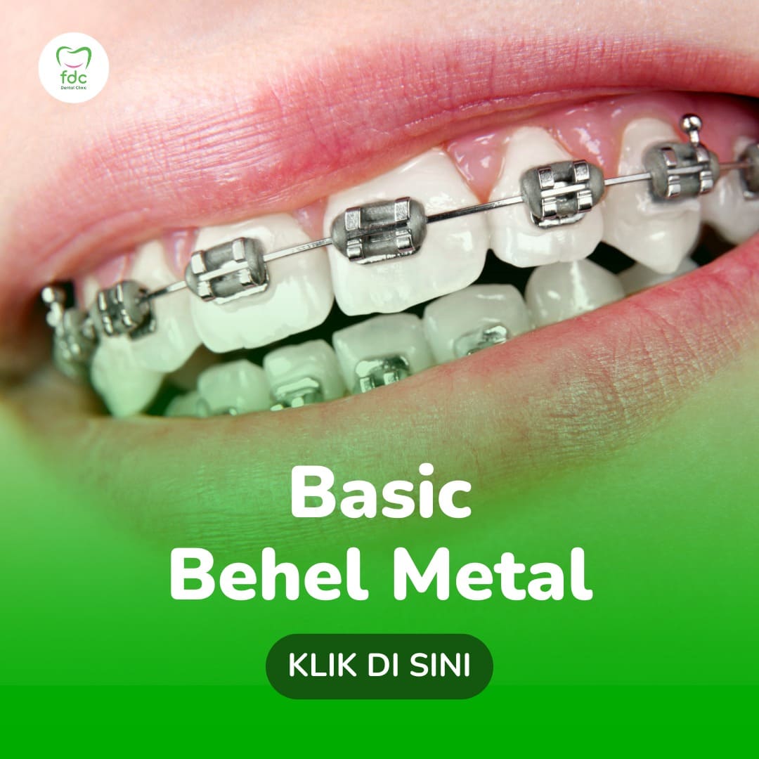 Pricelist | Basic Behel Metal